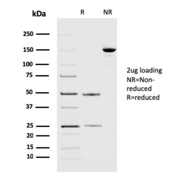 SDS-PAGE - Anti-PD-L2 Antibody [PDL2/2676] (A250390) - Antibodies.com