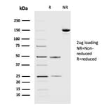 SDS-PAGE - Anti-PD-L2 Antibody [PDL2/2676] (A250390) - Antibodies.com