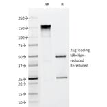 SDS-PAGE - Anti-FGF23 Antibody [FGF23/638] (A250390) - Antibodies.com