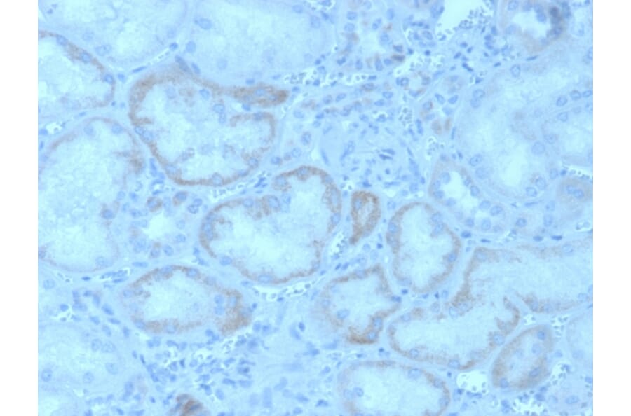 Immunohistochemistry - Anti-FGF23 Antibody [FGF23/4162] (A250392) - Antibodies.com