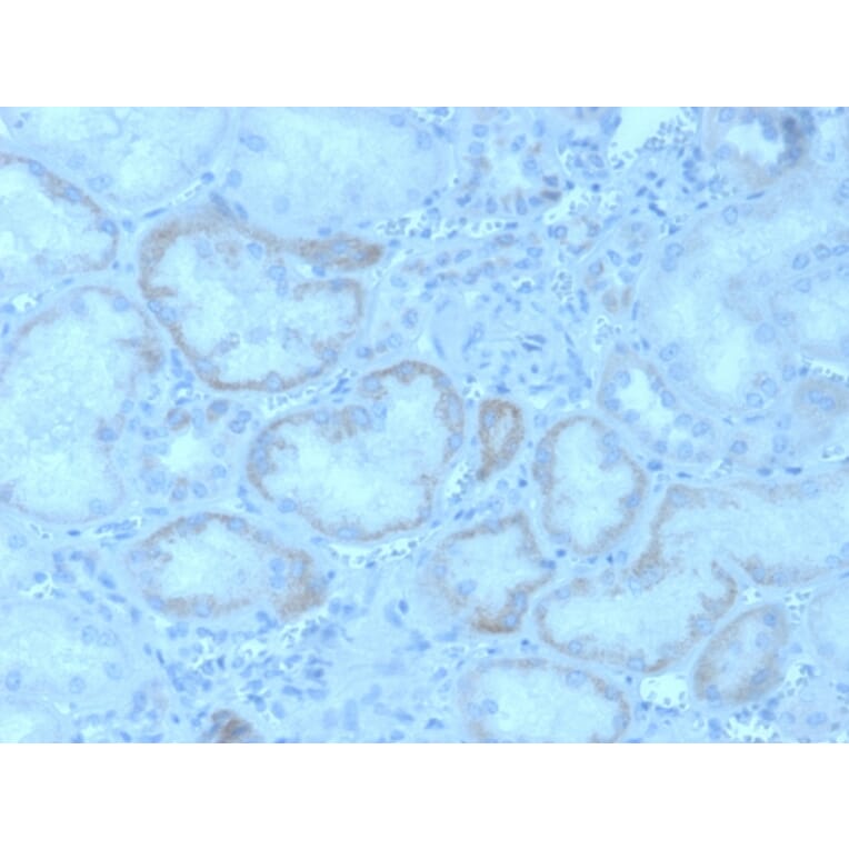 Immunohistochemistry - Anti-FGF23 Antibody [FGF23/4162] (A250392) - Antibodies.com