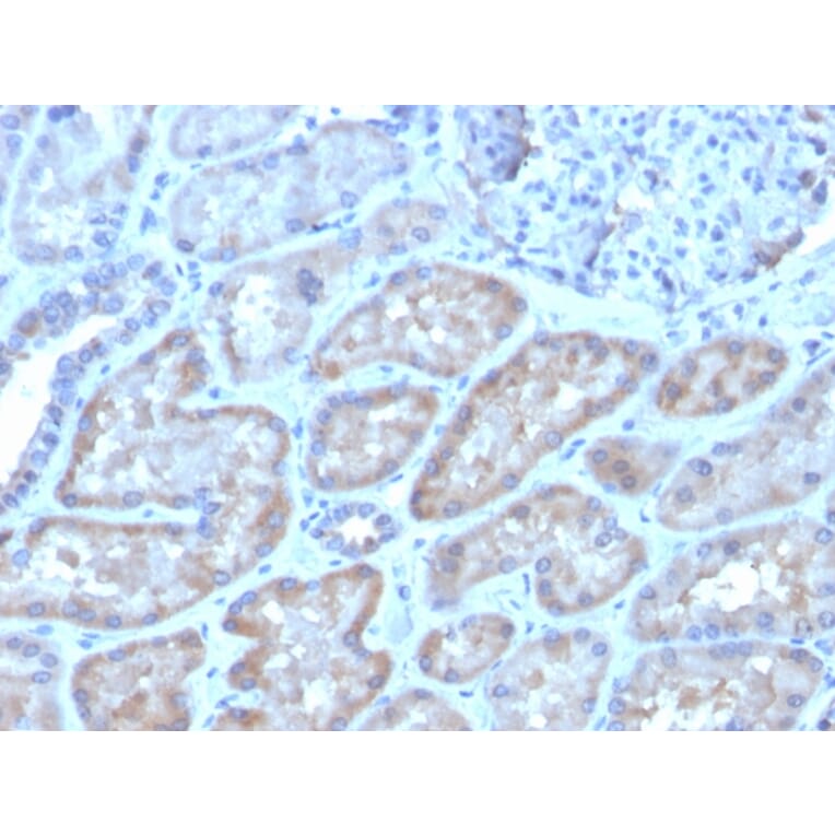 Immunohistochemistry - Anti-FGF23 Antibody [FGF23/4162] (A250392) - Antibodies.com