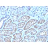 Immunohistochemistry - Anti-FGF23 Antibody [FGF23/4162] (A250392) - Antibodies.com