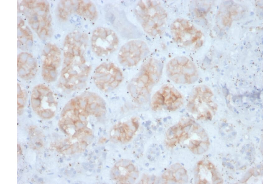 Immunohistochemistry - Anti-FGF23 Antibody [FGF23/4163] (A250393) - Antibodies.com
