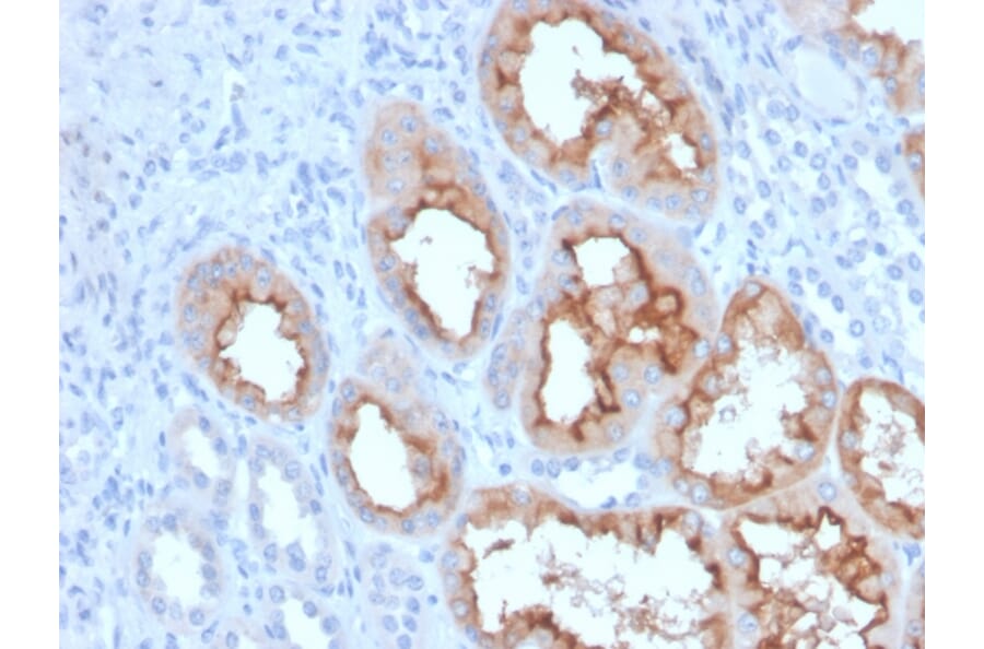 Immunohistochemistry - Anti-FGF23 Antibody [FGF23/4163] (A250393) - Antibodies.com