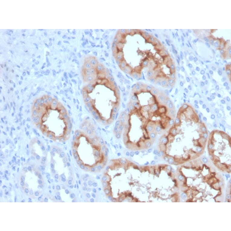 Immunohistochemistry - Anti-FGF23 Antibody [FGF23/4163] (A250393) - Antibodies.com