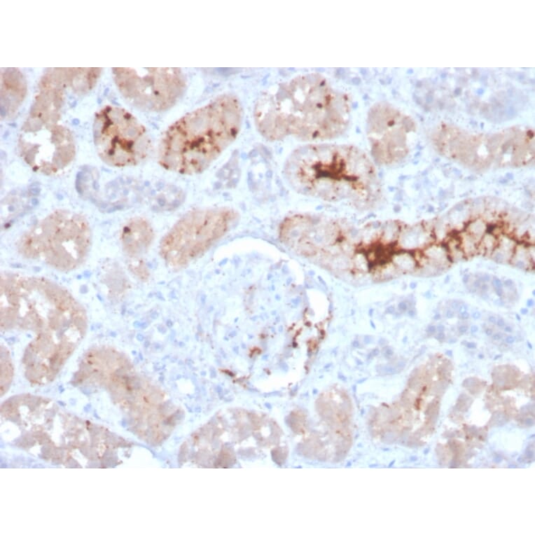 Immunohistochemistry - Anti-FGF23 Antibody [FGF23/4166] (A250394) - Antibodies.com