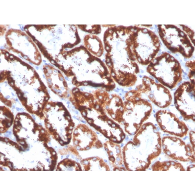 Immunohistochemistry - Anti-FGF23 Antibody [FGF23/4168] (A250395) - Antibodies.com