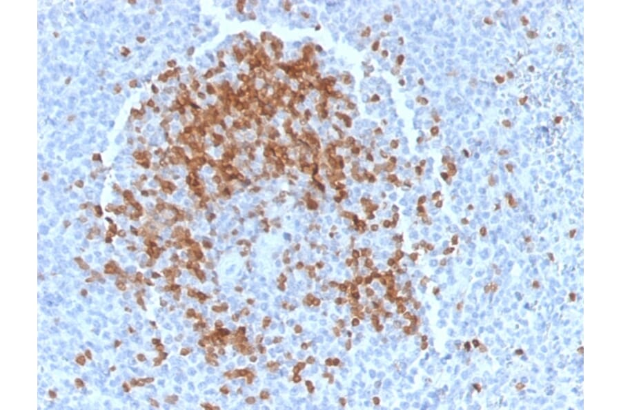 Immunohistochemistry - Anti-TCL1 Antibody [TCL1/2078] (A250396) - Antibodies.com