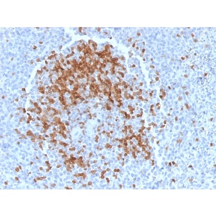 Immunohistochemistry - Anti-TCL1 Antibody [TCL1/2078] (A250396) - Antibodies.com