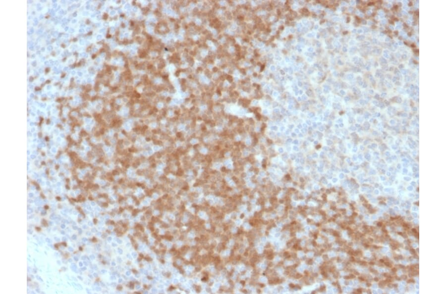 Immunohistochemistry - Anti-TCL1 Antibody [TCL1/2078] (A250396) - Antibodies.com