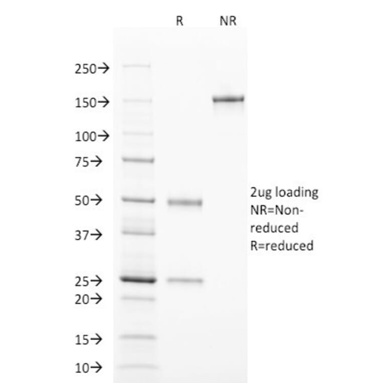 SDS-PAGE - Anti-TCL1 Antibody [TCL1/2078] (A250396) - Antibodies.com