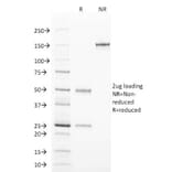 SDS-PAGE - Anti-TCL1 Antibody [TCL1/2078] (A250396) - Antibodies.com