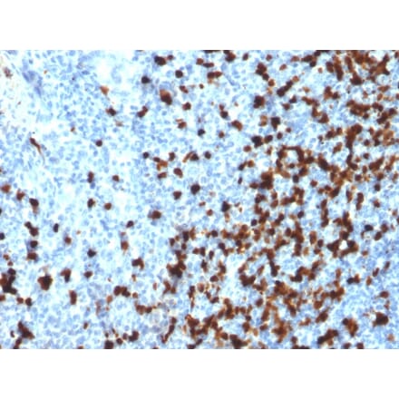 Immunohistochemistry - Anti-TCL1 Antibody [TCL1/2079] (A250397) - Antibodies.com