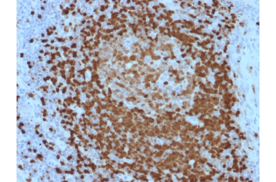 Immunohistochemistry - Anti-TCL1 Antibody [TCL1/2079] (A250397) - Antibodies.com