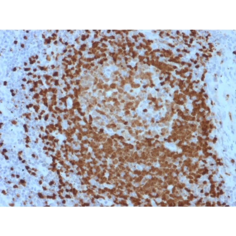 Immunohistochemistry - Anti-TCL1 Antibody [TCL1/2079] (A250397) - Antibodies.com