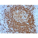 Immunohistochemistry - Anti-TCL1 Antibody [TCL1/2079] (A250397) - Antibodies.com