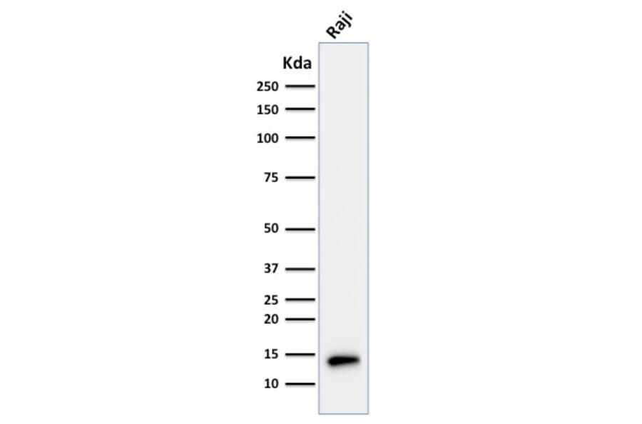 Western Blot - Anti-TCL1 Antibody [TCL1/2079] (A250397) - Antibodies.com