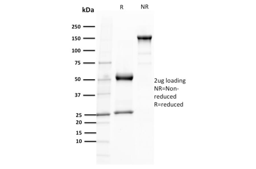 SDS-PAGE - Anti-TCL1 Antibody [TCL1/2079] (A250397) - Antibodies.com