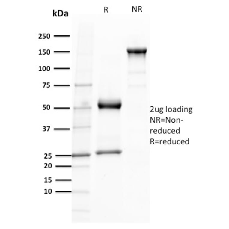 SDS-PAGE - Anti-TCL1 Antibody [TCL1/2079] (A250397) - Antibodies.com