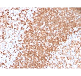 Immunohistochemistry - Anti-TCL1 Antibody [TCL1/2747R] (A250398) - Antibodies.com