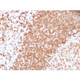 Immunohistochemistry - Anti-TCL1 Antibody [TCL1/2747R] (A250398) - Antibodies.com