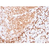 Immunohistochemistry - Anti-TCL1 Antibody [TCL1/2747R] (A250397) - Antibodies.com