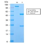 SDS-PAGE - Anti-TCL1 Antibody [TCL1/2747R] (A250398) - Antibodies.com