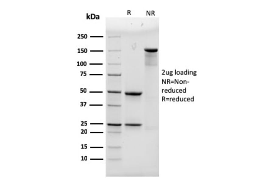 SDS-PAGE - Anti-alpha Actinin 4 Antibody [93] (A250398) - Antibodies.com