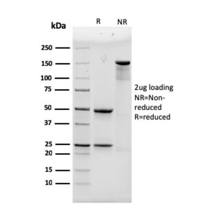 SDS-PAGE - Anti-alpha Actinin 4 Antibody [93] (A250398) - Antibodies.com