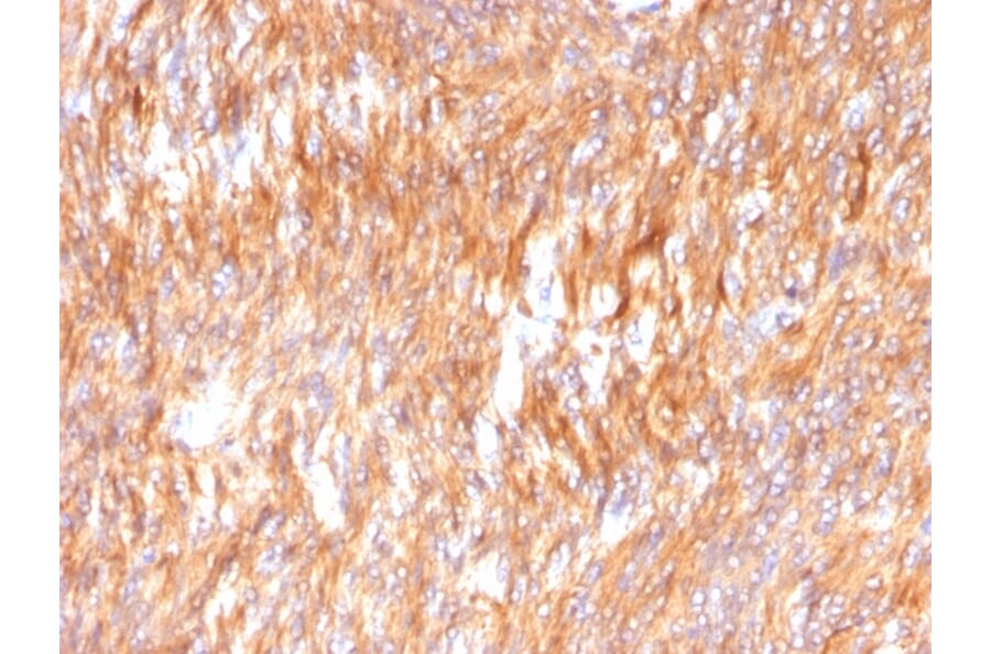 Immunohistochemistry - Anti-Calnexin Antibody [CANX/1541] (A250400) - Antibodies.com
