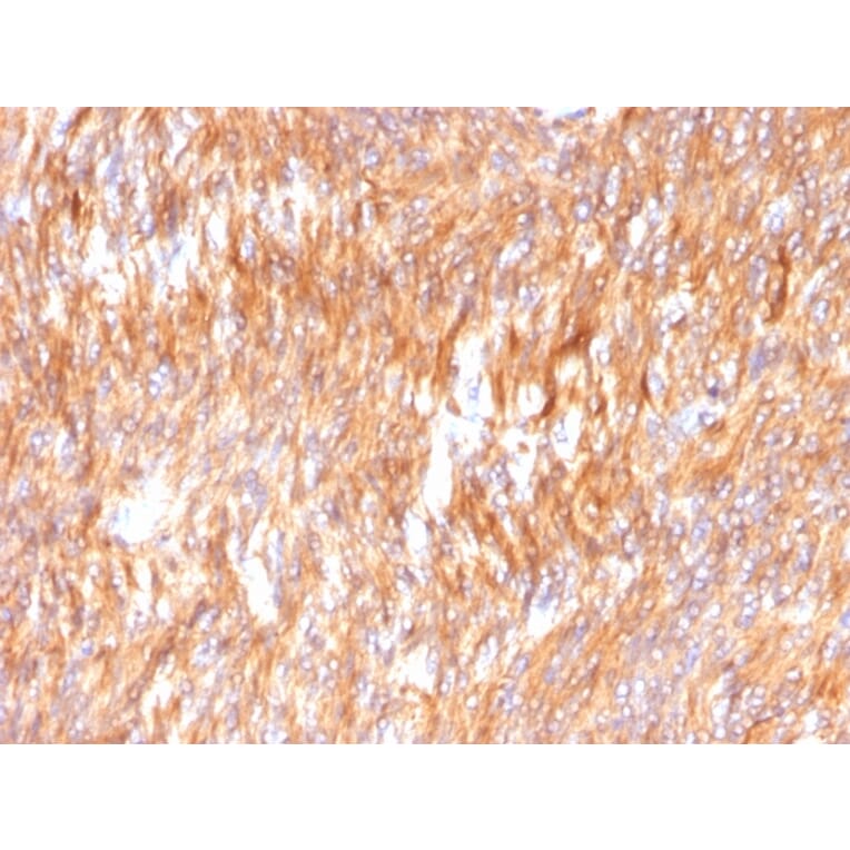 Immunohistochemistry - Anti-Calnexin Antibody [CANX/1541] (A250400) - Antibodies.com