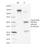 SDS-PAGE - Anti-Calnexin Antibody [CANX/1541] (A250400) - Antibodies.com