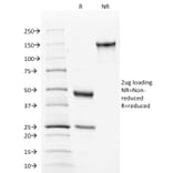 SDS-PAGE - Anti-Calnexin Antibody [CANX/1543] (A250401) - Antibodies.com