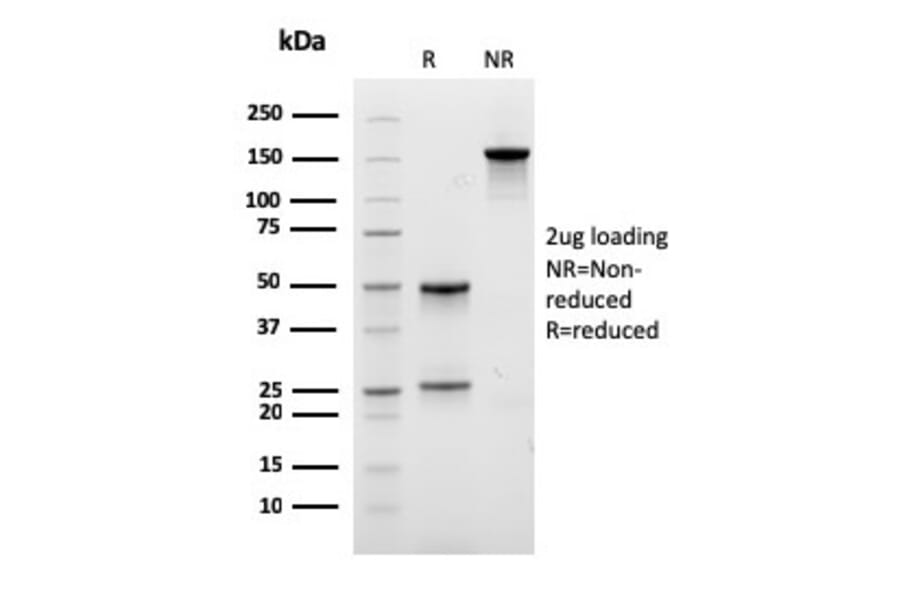 SDS-PAGE - Anti-EPX Antibody [EPX/3908R] (A250406) - Antibodies.com