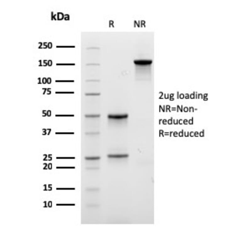 SDS-PAGE - Anti-EPX Antibody [EPX/3908R] (A250406) - Antibodies.com