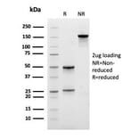 SDS-PAGE - Anti-EPX Antibody [EPX/3908R] (A250406) - Antibodies.com