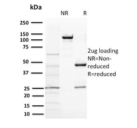 SDS-PAGE - Anti-BAP1 Antibody [BAP1/2431] (A250407) - Antibodies.com