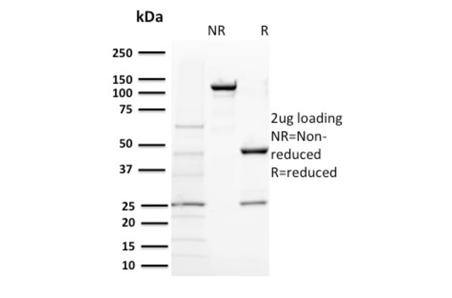 SDS-PAGE - Anti-BAP1 Antibody [BAP1/2431] (A250407) - Antibodies.com
