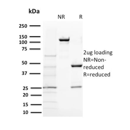 SDS-PAGE - Anti-BAP1 Antibody [BAP1/2431] (A250407) - Antibodies.com