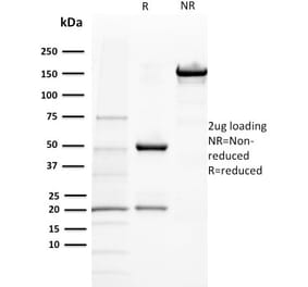 SDS-PAGE - Anti-BAP1 Antibody [BAP1/2432] (A250408) - Antibodies.com