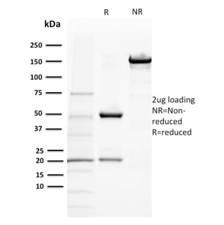 SDS-PAGE - Anti-BAP1 Antibody [BAP1/2432] (A250408) - Antibodies.com