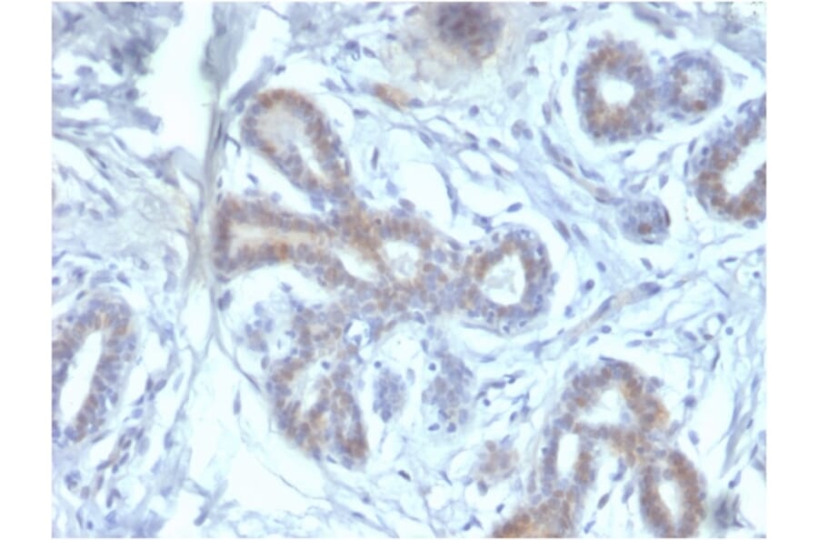 Immunohistochemistry - Anti-BAP1 Antibody [BAP1/2433] (A250408) - Antibodies.com