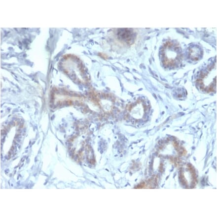 Immunohistochemistry - Anti-BAP1 Antibody [BAP1/2433] (A250408) - Antibodies.com