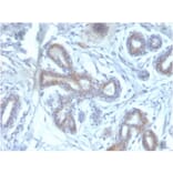 Immunohistochemistry - Anti-BAP1 Antibody [BAP1/2433] (A250408) - Antibodies.com