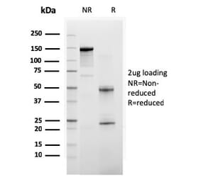 SDS-PAGE - Anti-BAP1 Antibody [BAP1/2665] (A250410) - Antibodies.com