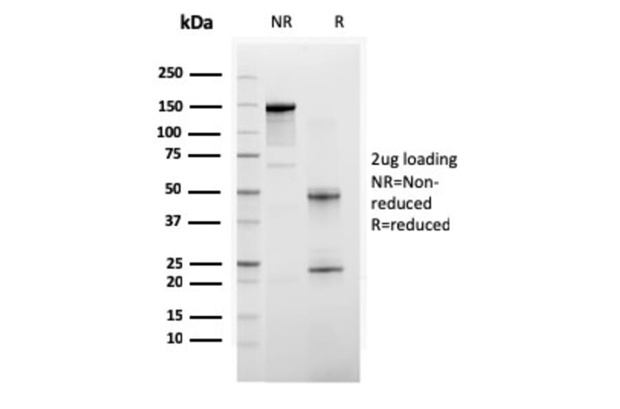 SDS-PAGE - Anti-BAP1 Antibody [BAP1/2665] (A250410) - Antibodies.com