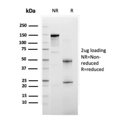 SDS-PAGE - Anti-BAP1 Antibody [BAP1/2665] (A250410) - Antibodies.com