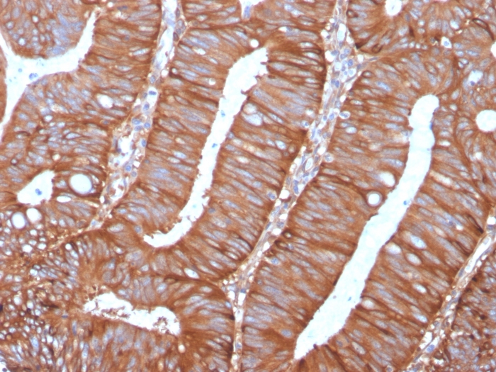 Immunohistochemistry - Anti-Calpastatin Antibody [CAST/1550] (A250412) - Antibodies.com