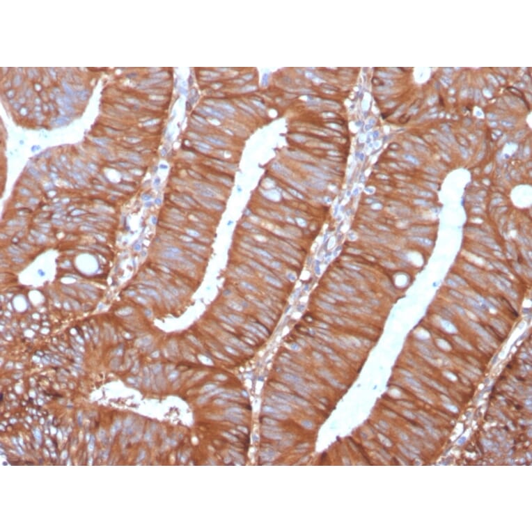 Immunohistochemistry - Anti-Calpastatin Antibody [CAST/1550] (A250412) - Antibodies.com